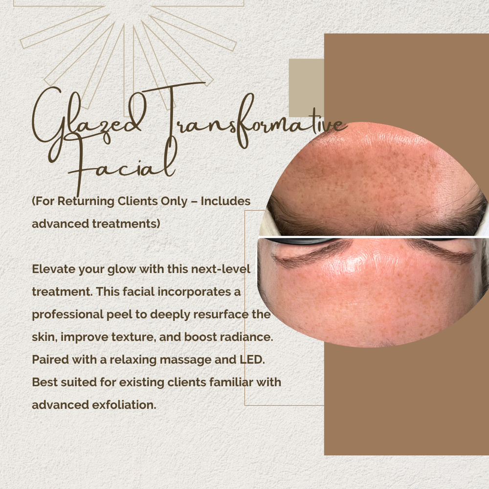Glazed Transformative Facial