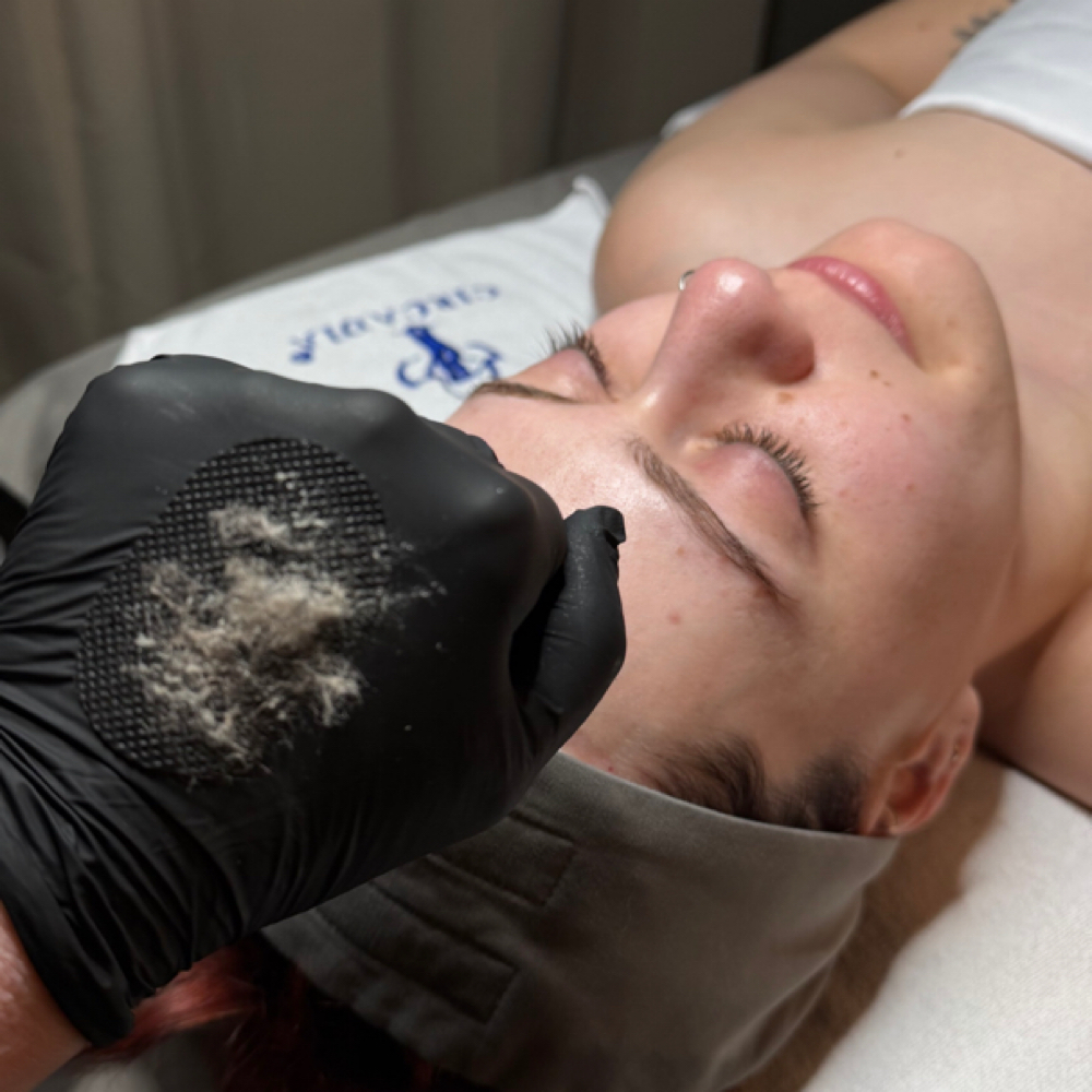 Dead Skin Hexfoliation at Dea Litsa Facial Spa in Chicago, IL