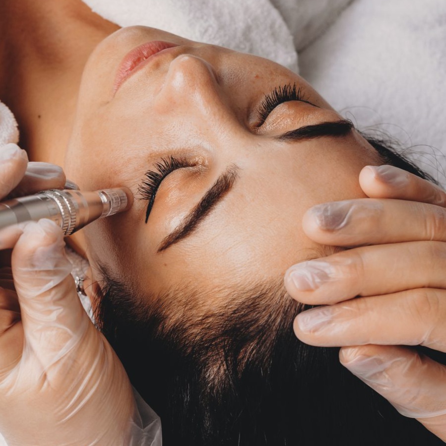 Microdermabrasion Facial at Spa Ravine Med Aesthetics in wayne, NJ