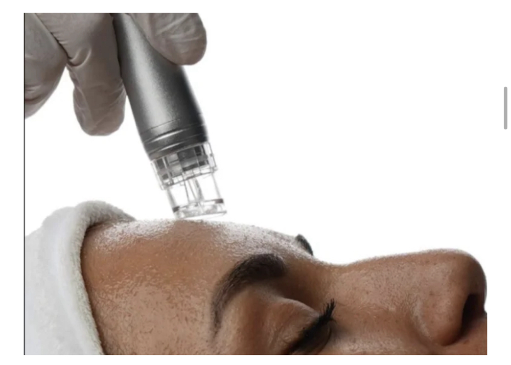Zemits Hydro Diamond Facial at Serene.Esthetics in Franklin Square, NY