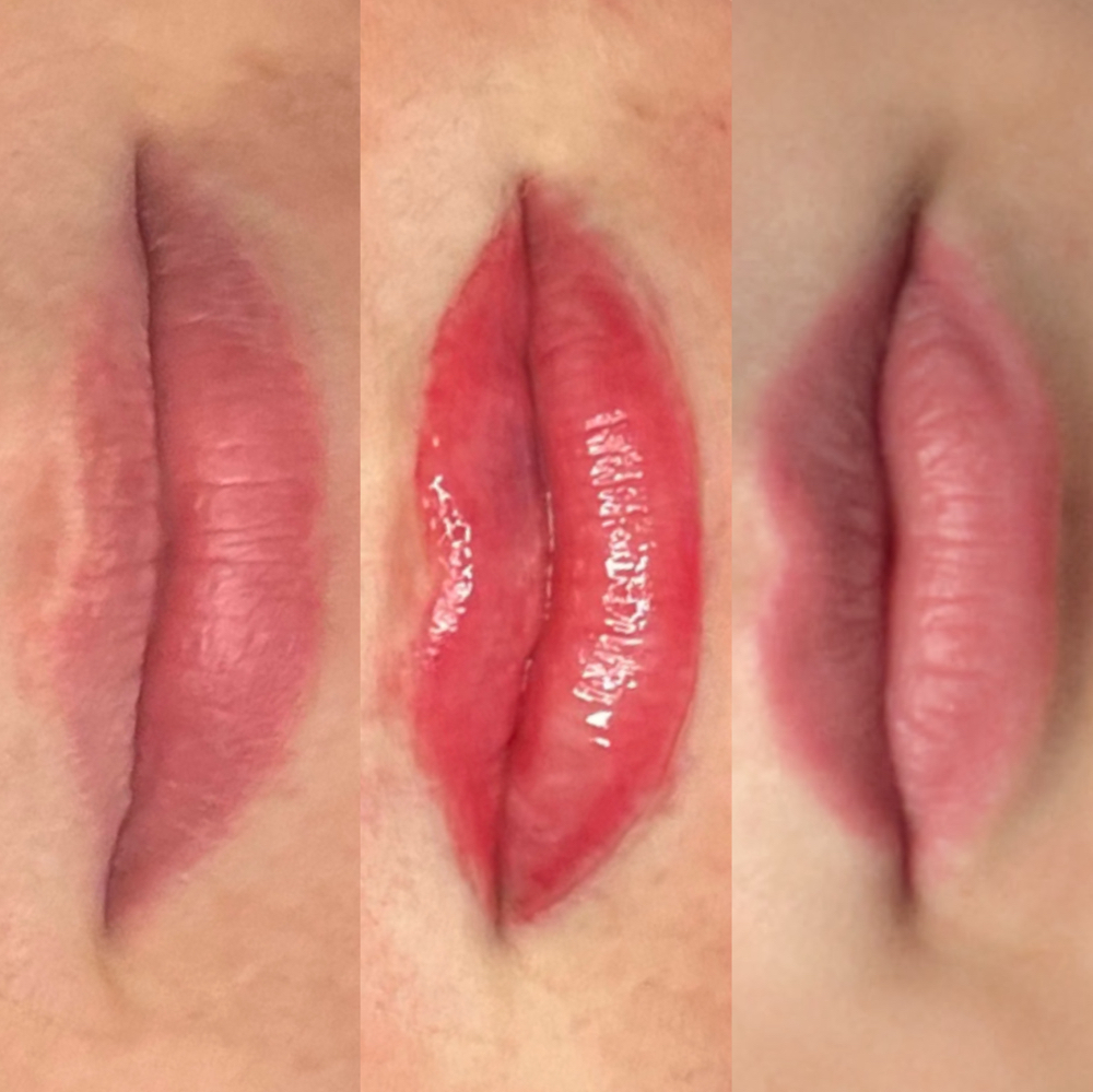 Lips - Required 8-12 Week Touch-Up