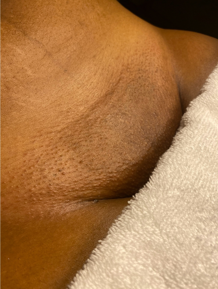 Bikini at Sonder Skin in Newport News, VA