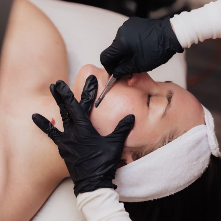 DERMAPLANE FACIAL at Birth of Venus in Los Gatos, CA