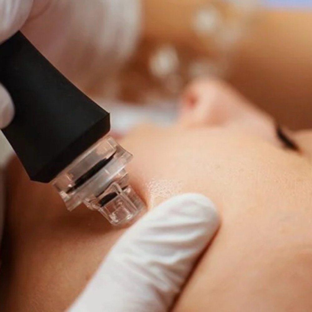 Add on to facial at Esthetics_byleza in Menifee, CA