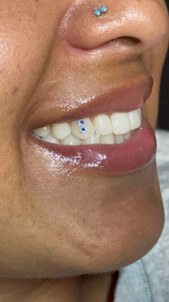 Tooth Gems