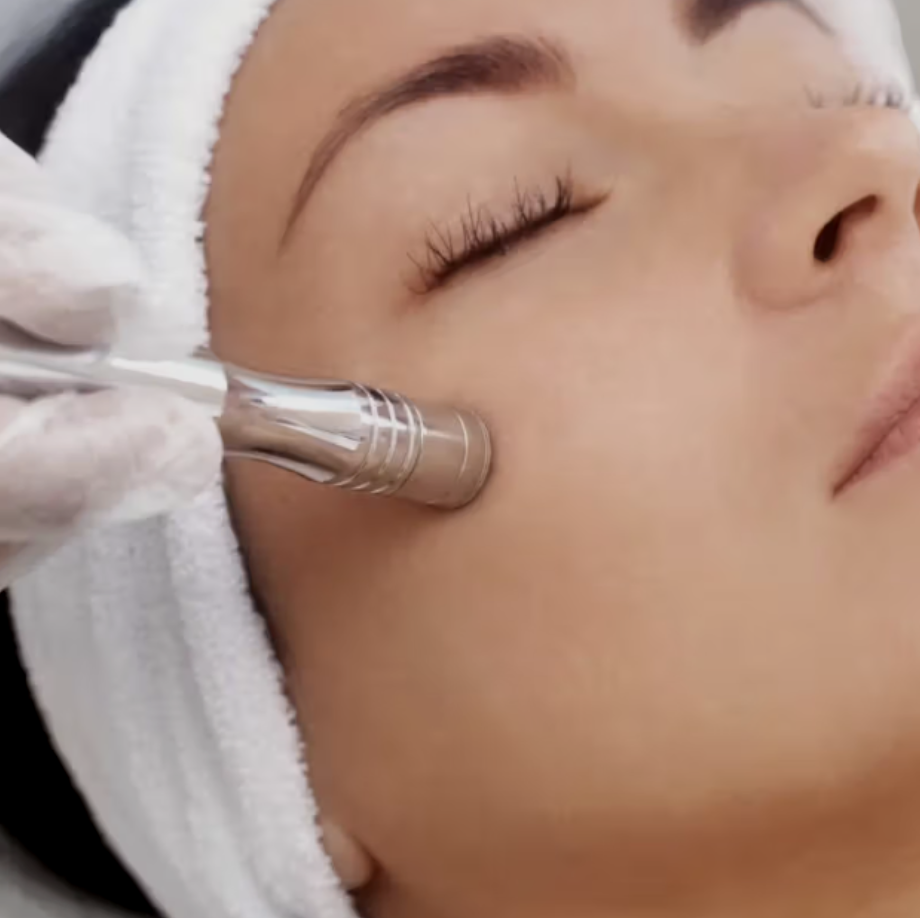 Microneedling Session