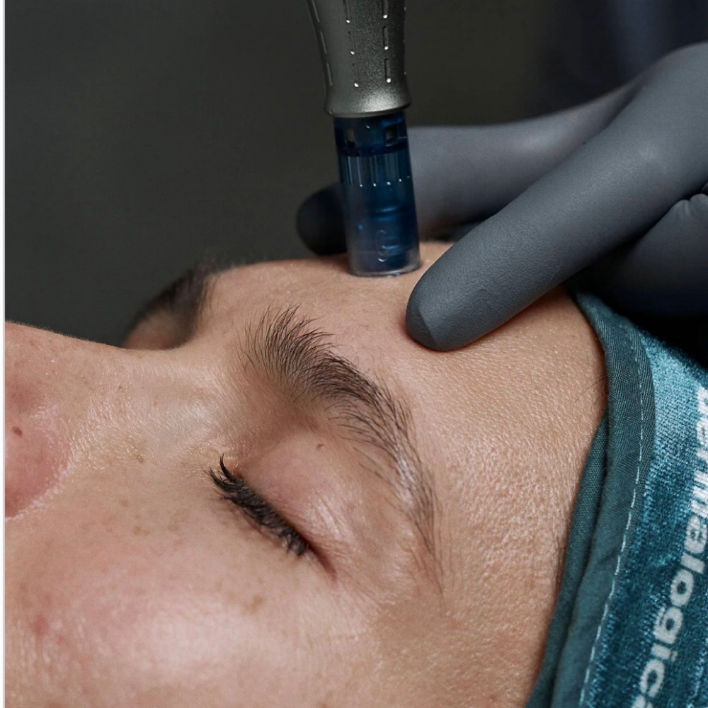 Add - MicroNeedling To UltraBright at Sinful Glow Skin Studio in Fuquay Varina, NC