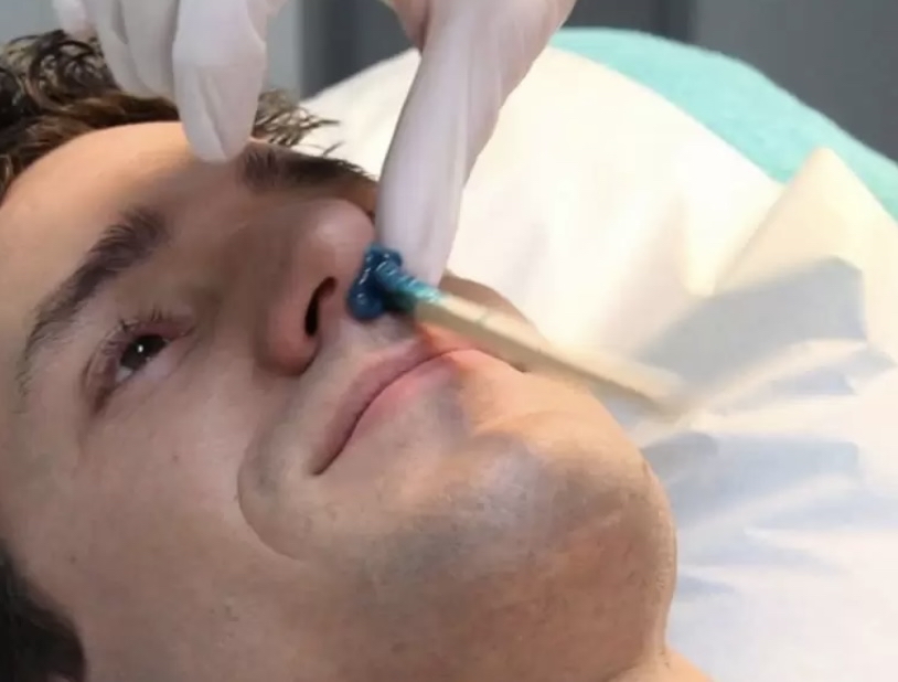 Nose Wax Men