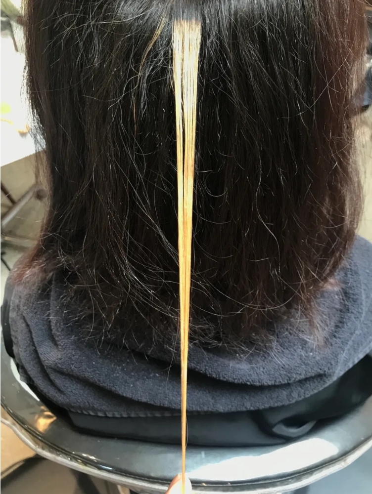 Consultation- With Test Strand