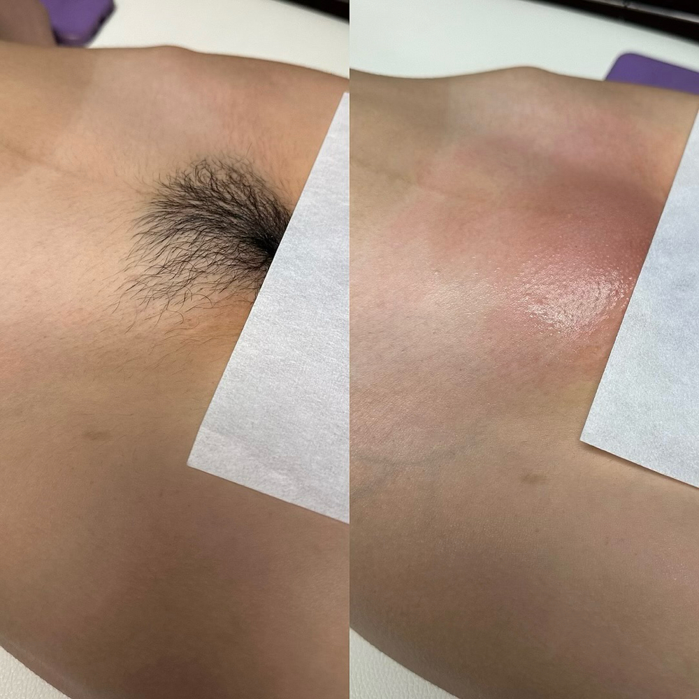 7 BRAZILIAN BUNDLE - $100 OFF !!!