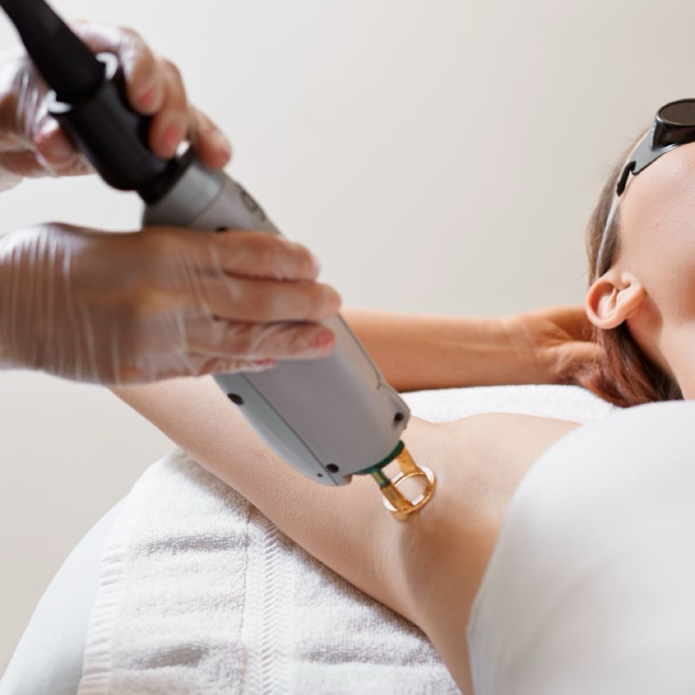 Laser Hair Removal 🔦 at Marbett Beauty Salon in Riverside, IL