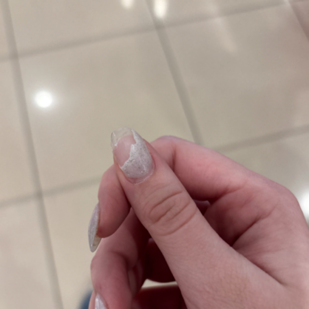 Nail Fix (after 2 Weeks) at Coastal Nail Co. in Belville, NC