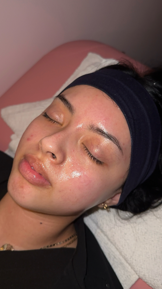 DermaGlow Facial