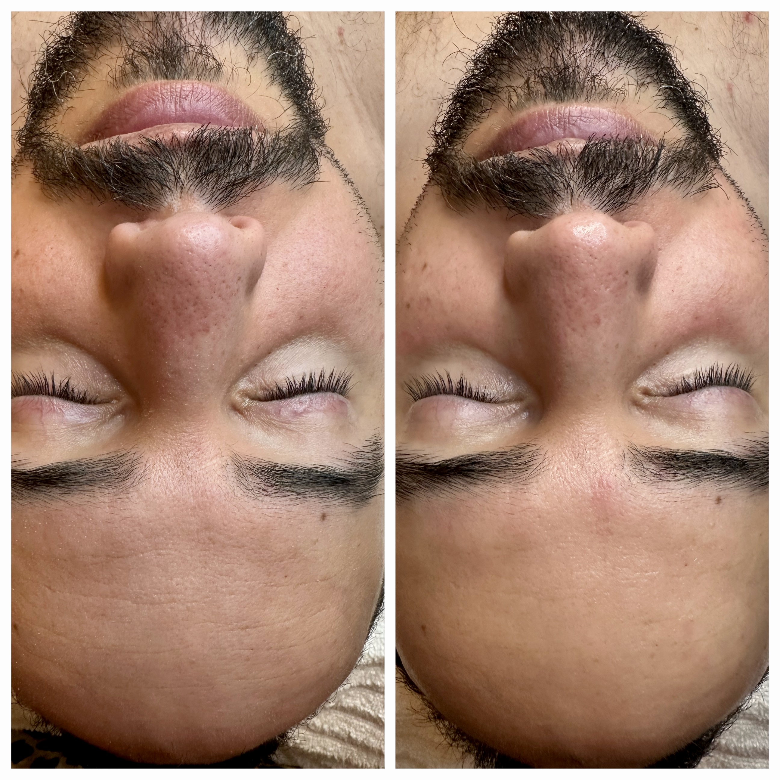 "Refined Radiance"