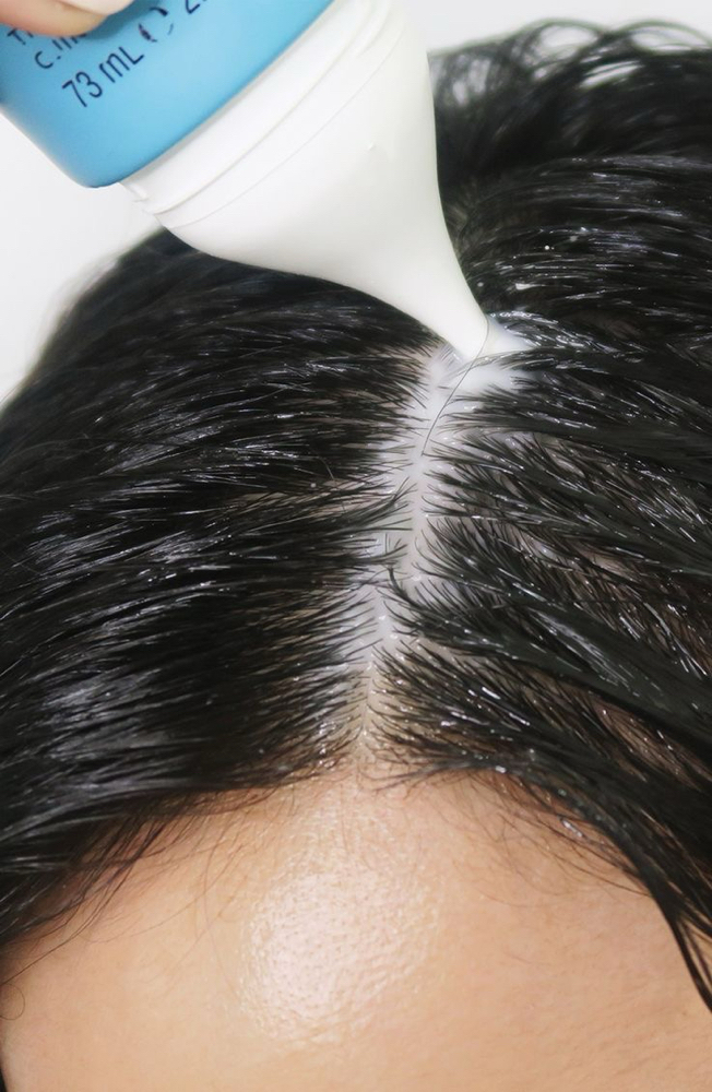 Scalp Treatment