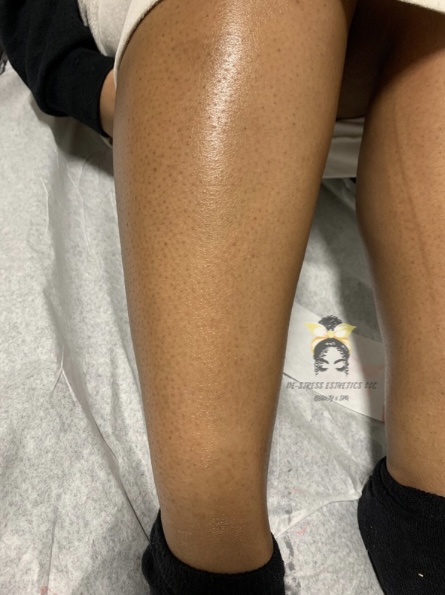 Leg Wax at De-Stress Esthetics LLC in Saint Louis, MO
