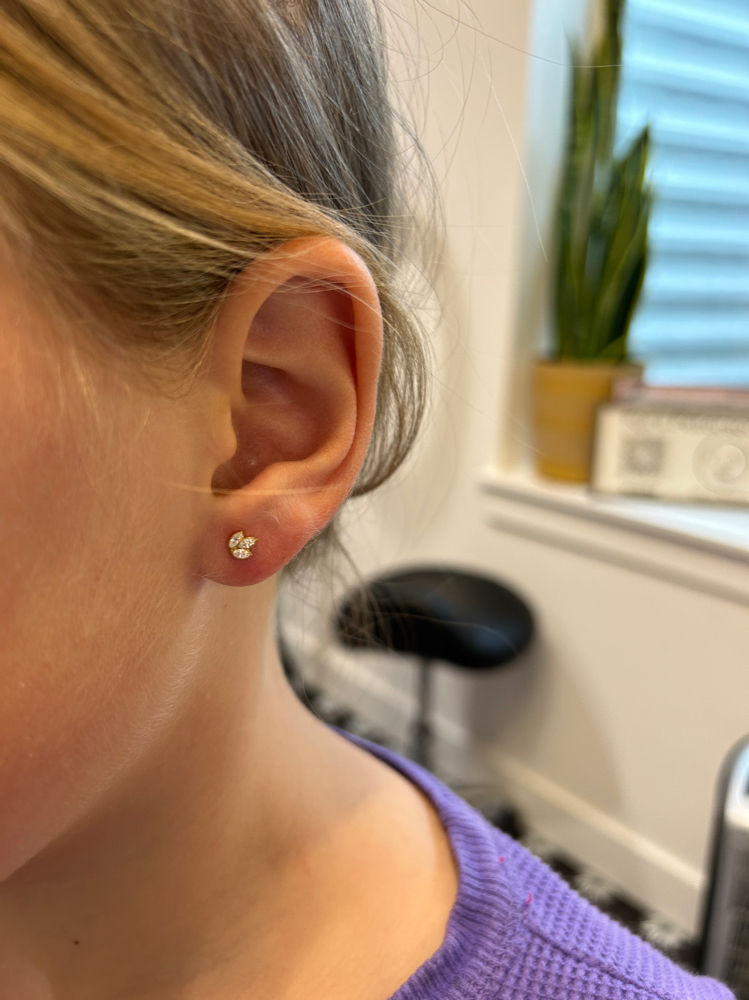 Single Lobe