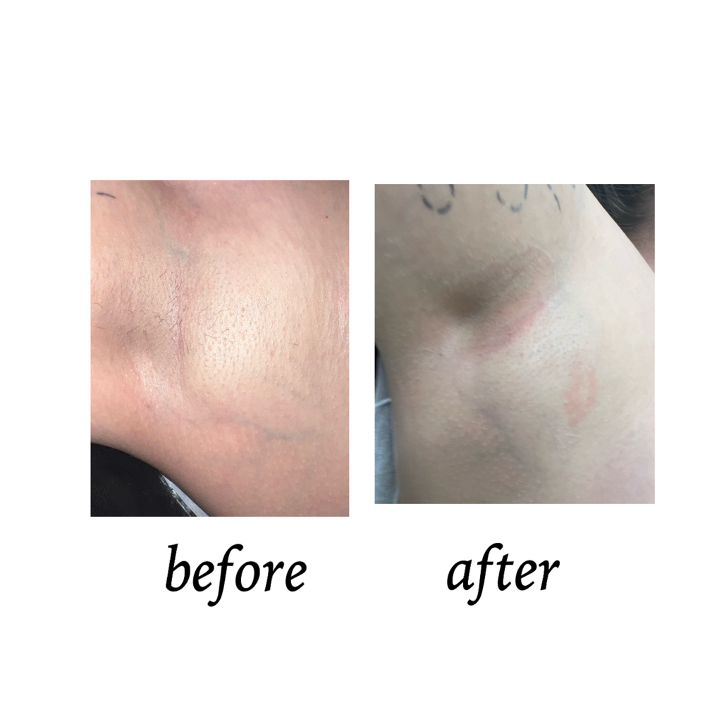 Underarm at Valaijiah Hamilton in Janesville, WI