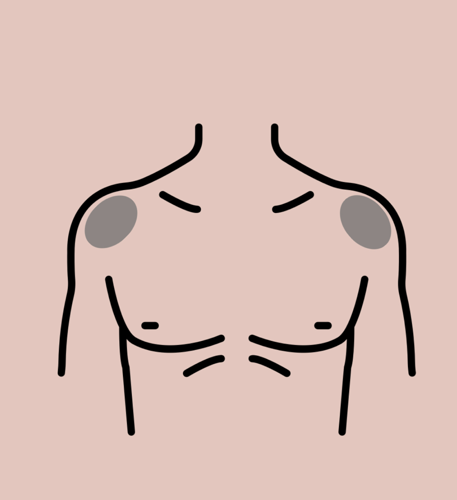 Shoulders Treatment