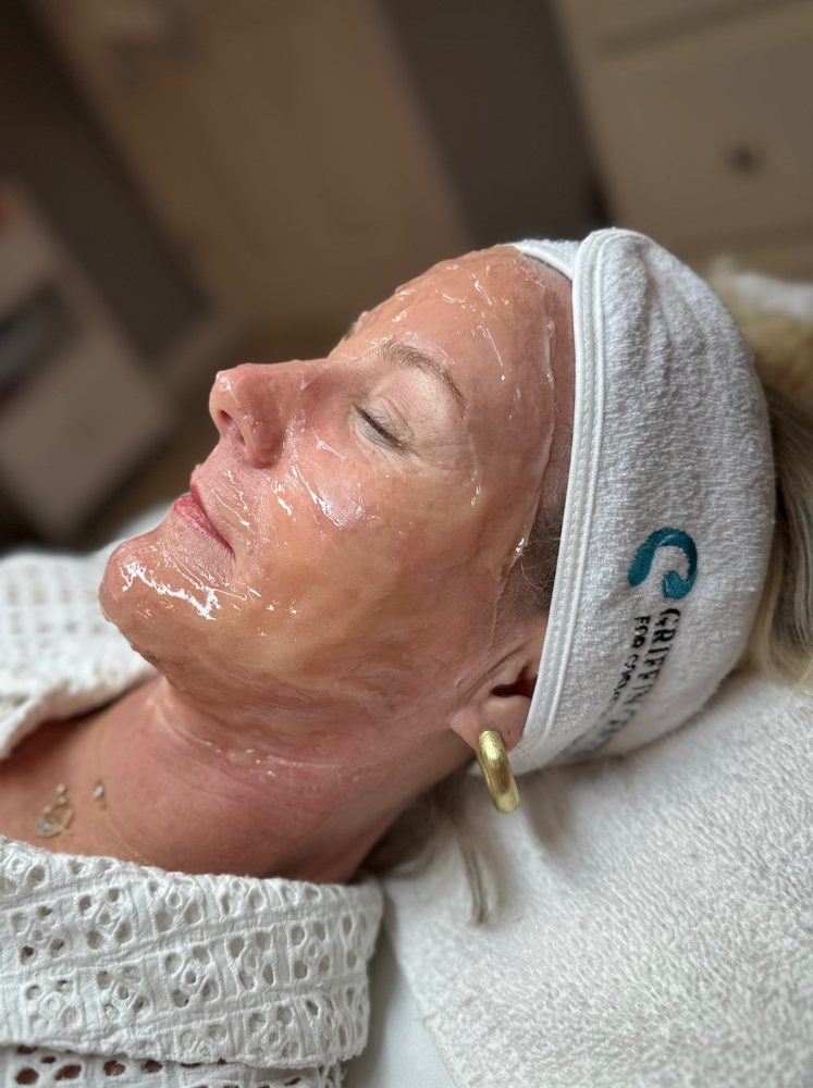 CO2 Lift Pro at Skin By Ragan in Columbus, MS