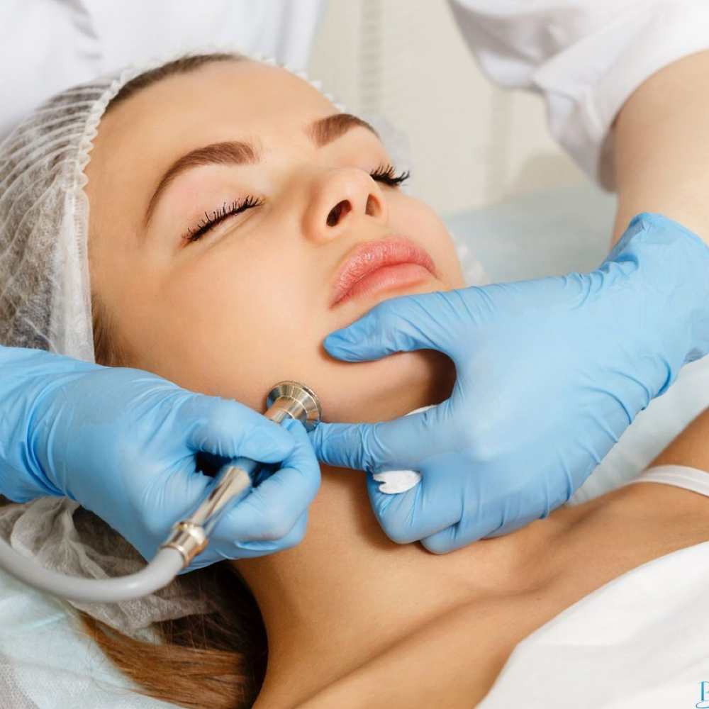 Microdermabrasion Facial at Madína Beauté Studío in Las Vegas, NV