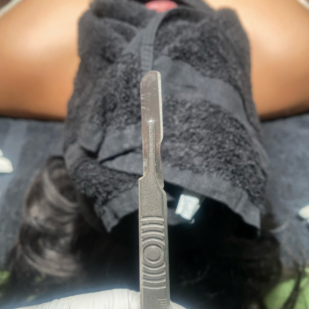 Dermaplaning (Servicio adicional) at Pure Canvas Co. in San Jose, CA