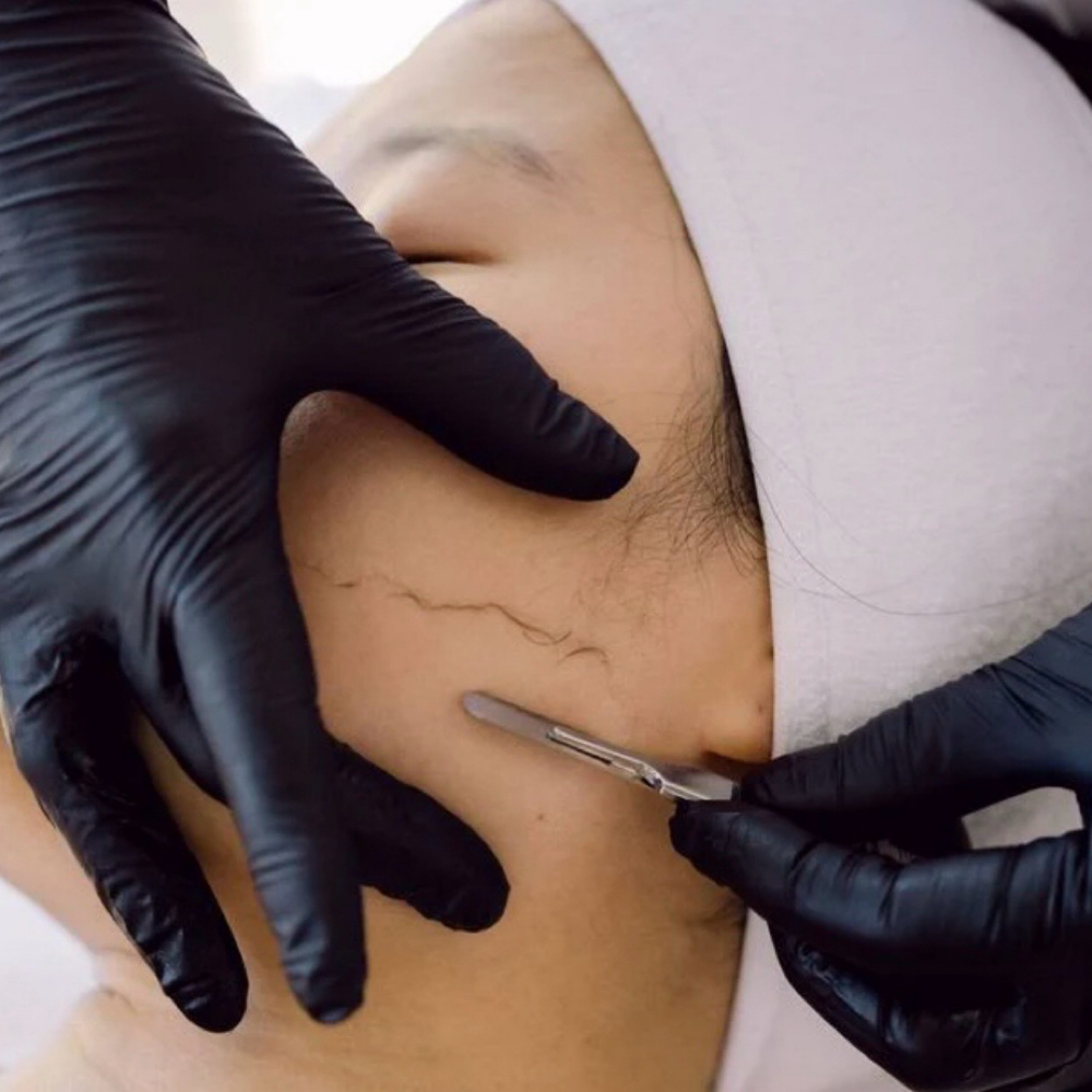 Dermaplane Facial at Skn2Skn Aesthetics in Chicago, IL