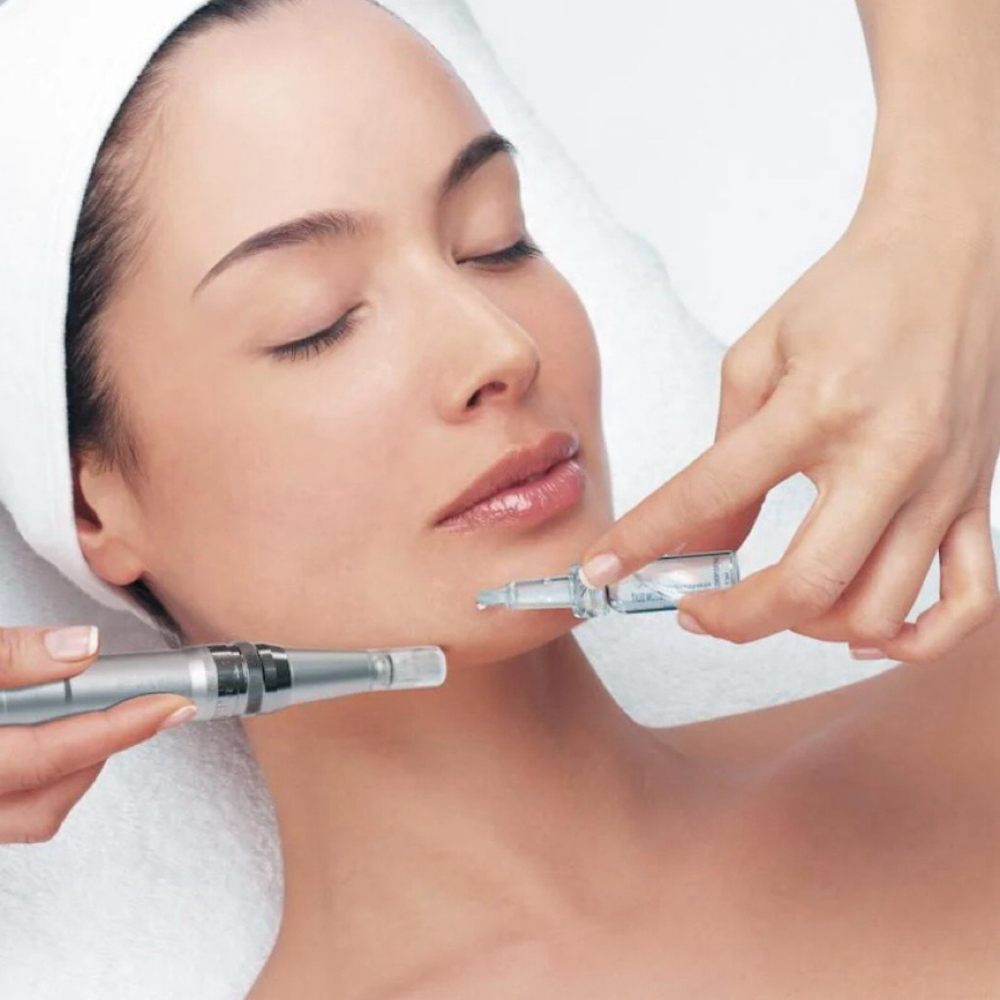 Advanced Microneedling at 3.2.1..GLO! in Bloomingdale, IL