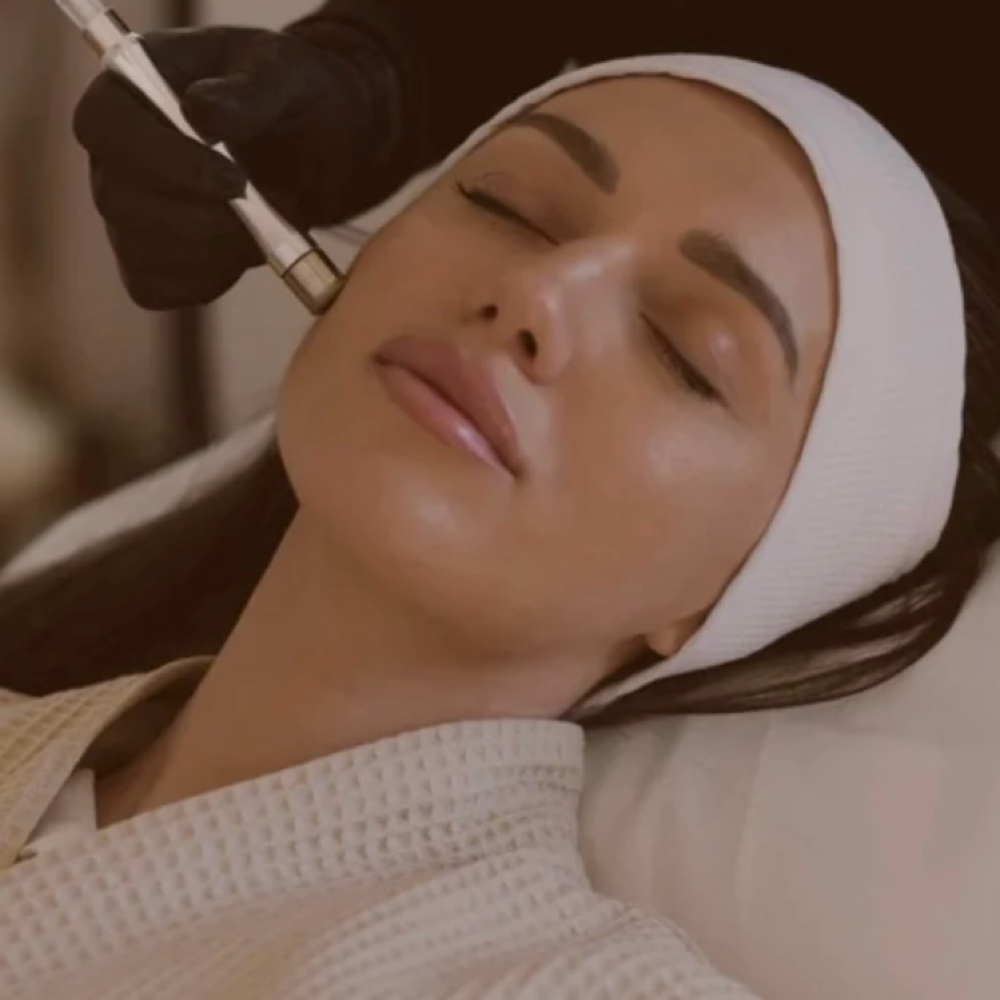 Facial de Microdermoabrasión at Carmen’s Beauty and Skincare in Fellsmere, FL