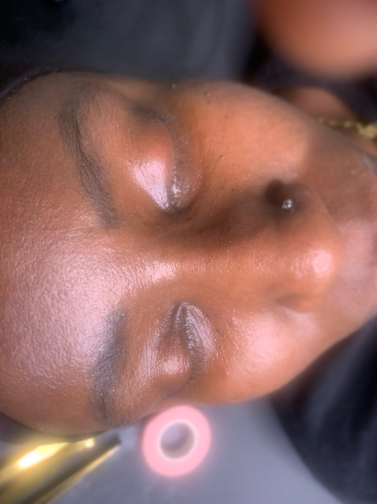 Lash Removal