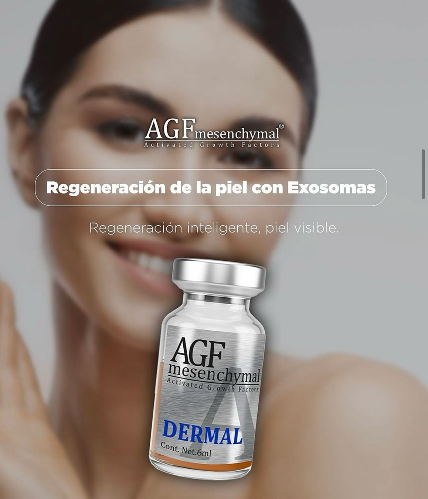 Exosomas AGF