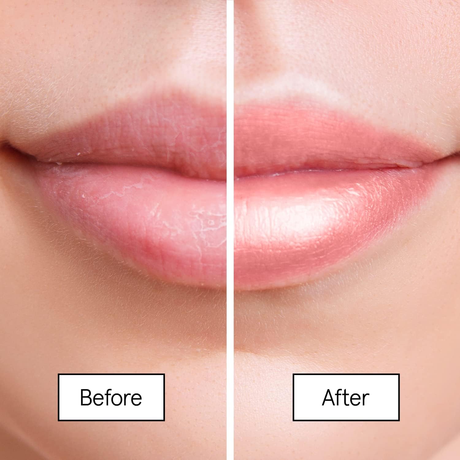 Lip Mask Treatment