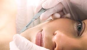 Facial Dermaplaning