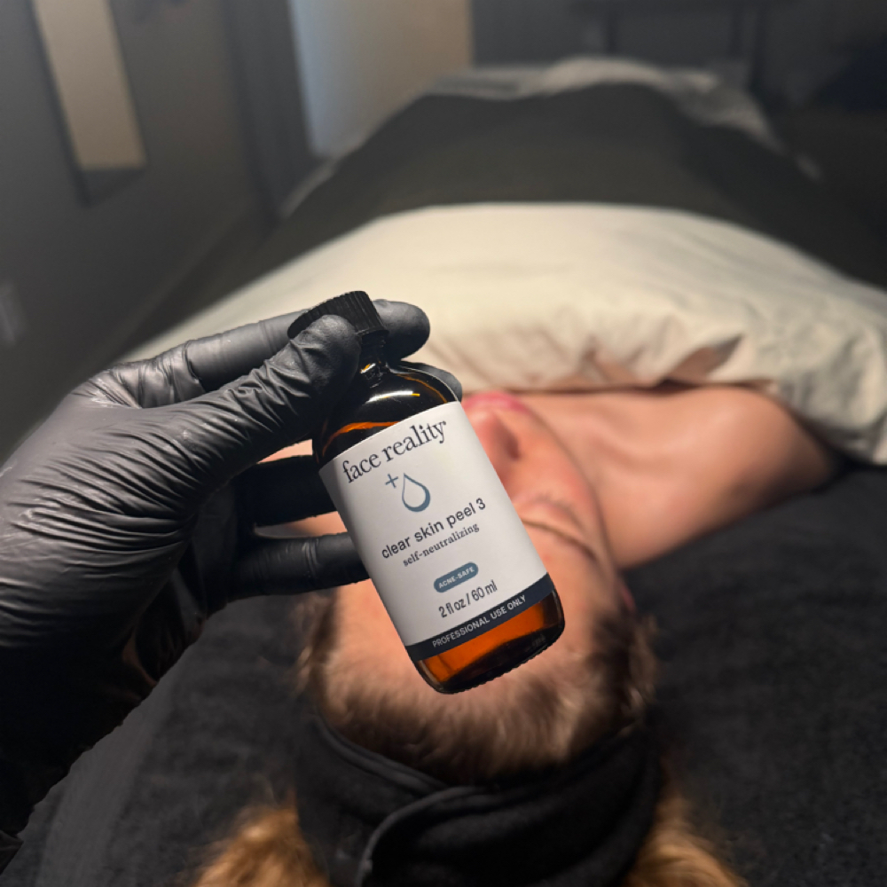Acne Bootcamp Facial at Madi Coca Aesthetics At The Skin Refinery in Nicholasville, KY