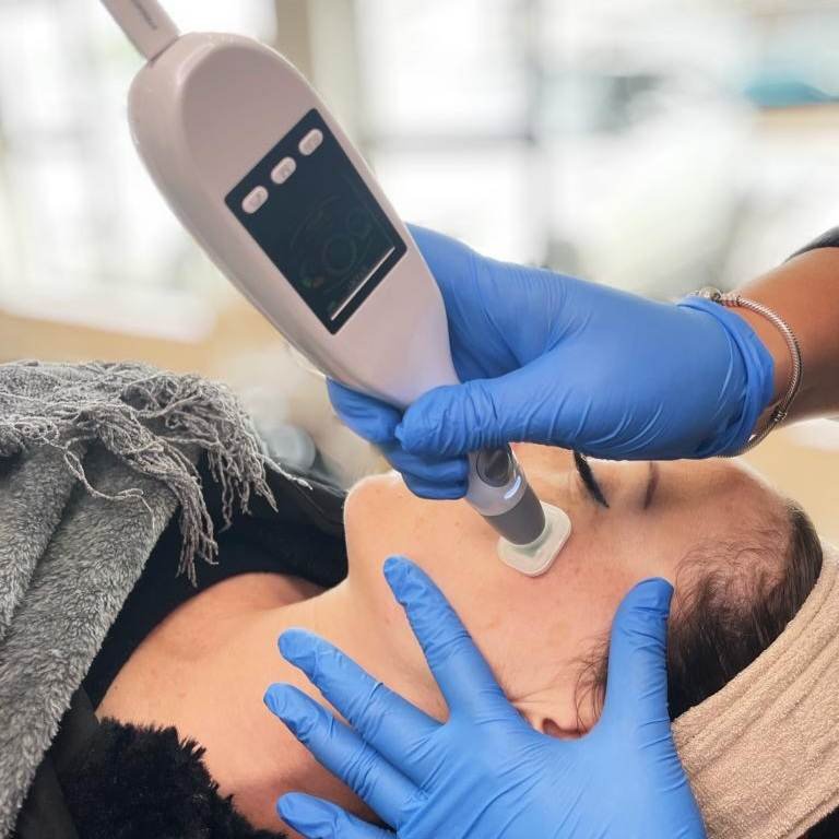 Jet Plasma Treatment 5 Treatments