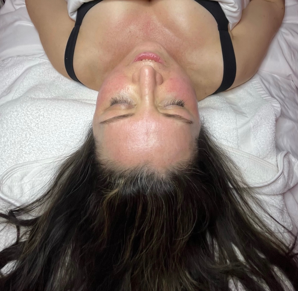 Diamond Hydra Facial