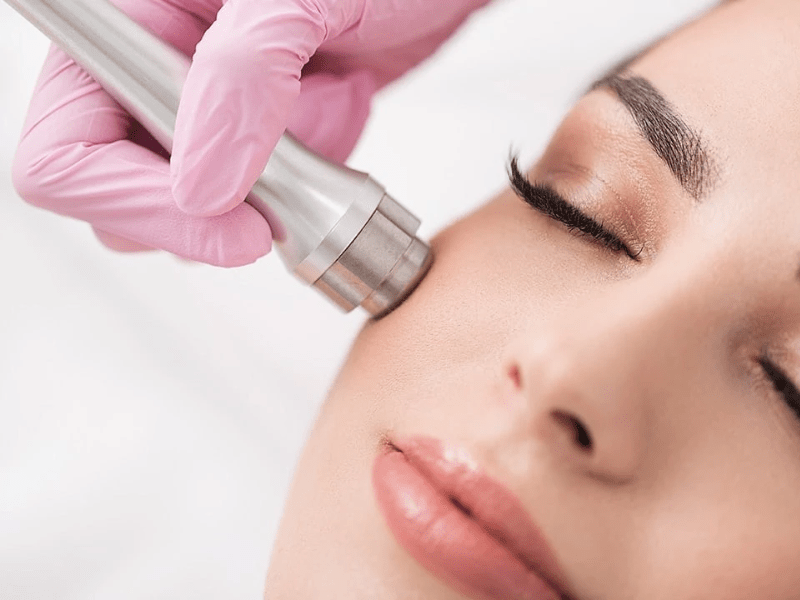 Basic Microdermabrasion Facial