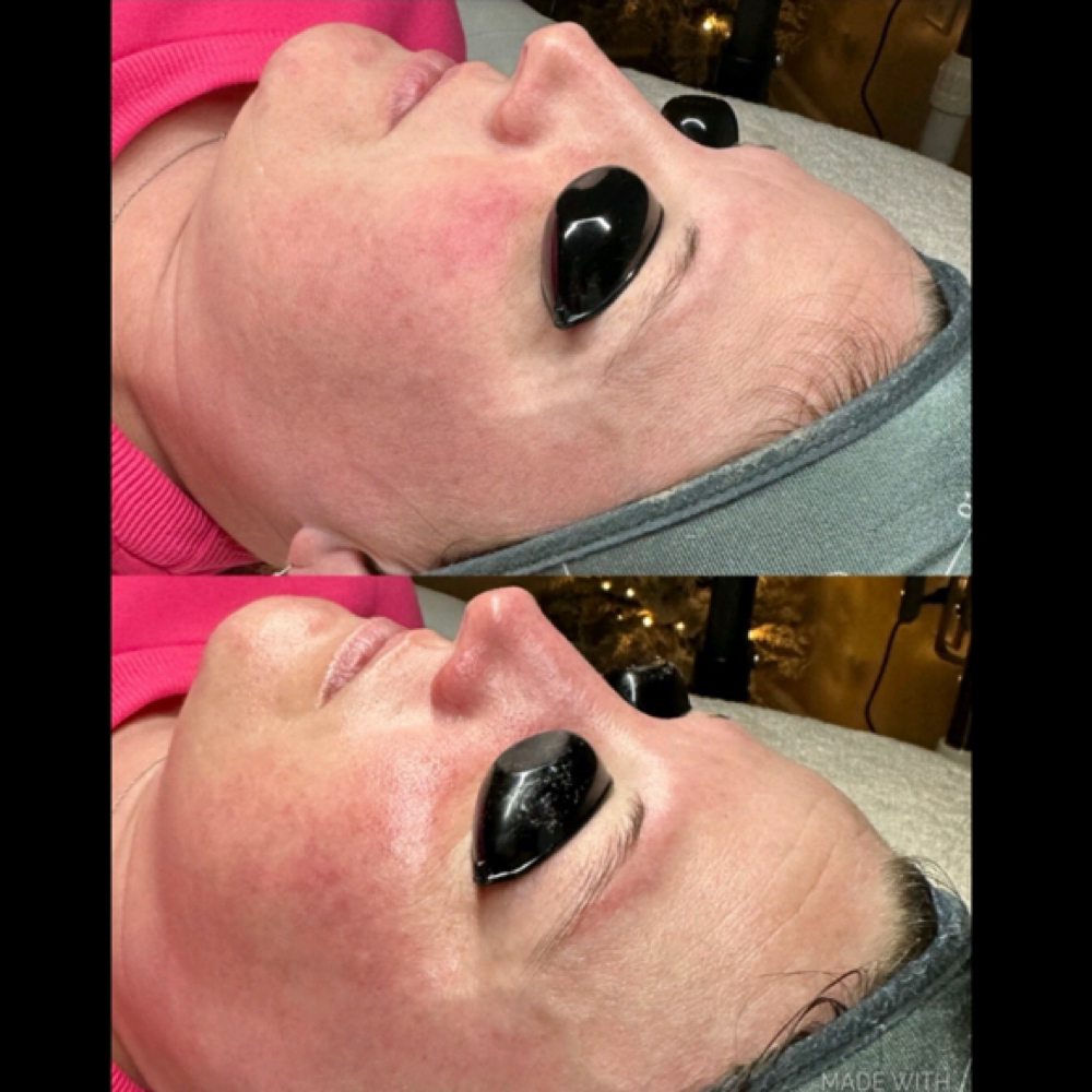 Oxygen Rx Treatment at Sculpted by Gennah in South Glens Falls, NY