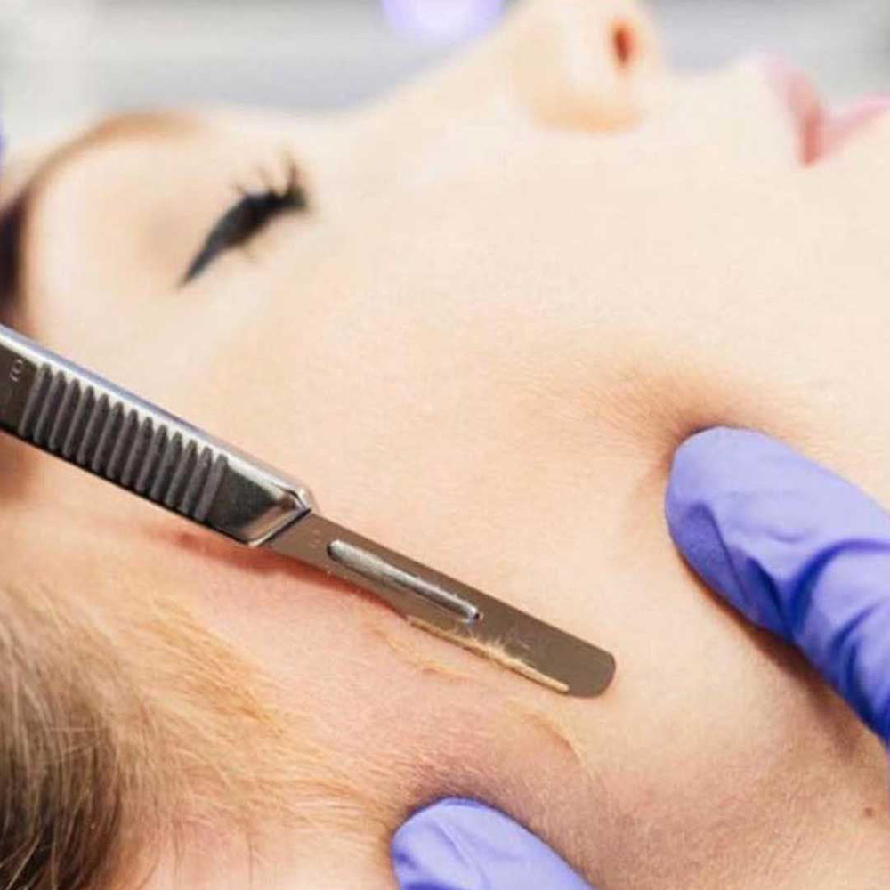 Dermaplaning Facial