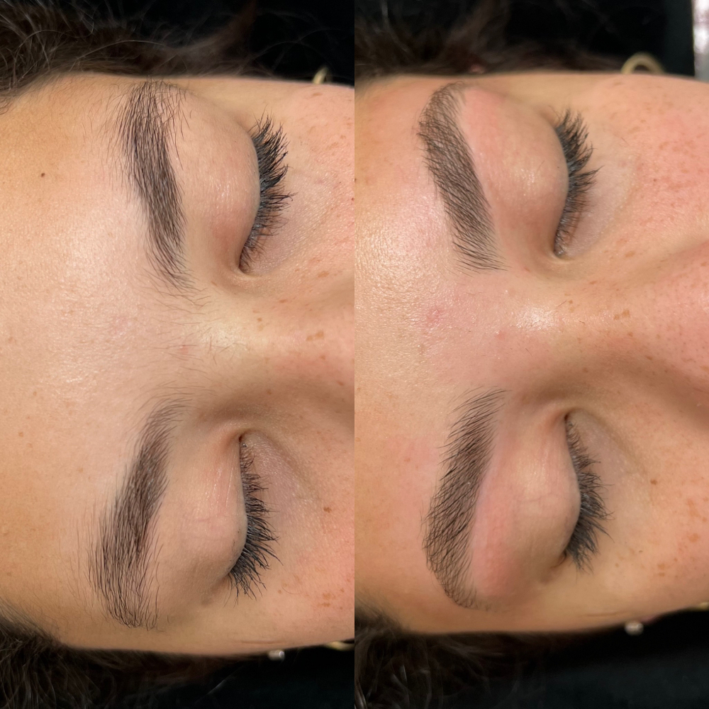 Brow Shaping