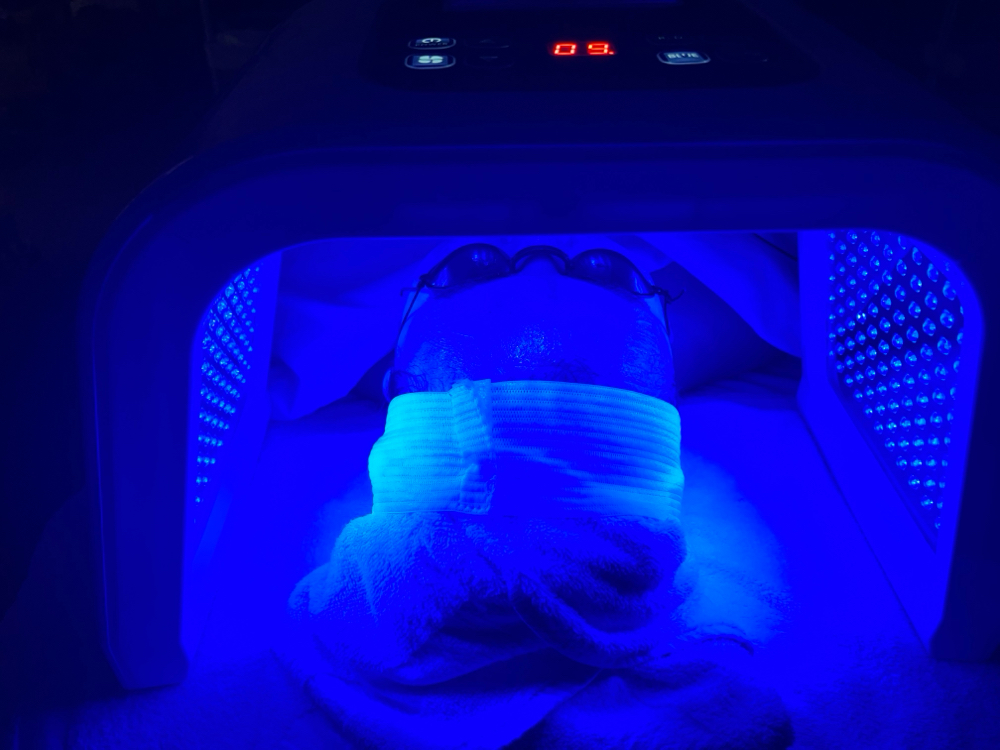 Add On LED Light Therapy