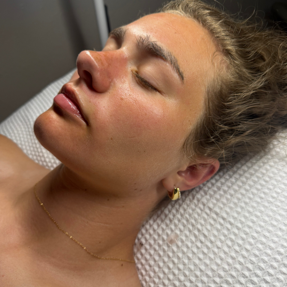 Summer Escape Facial at Halo Aesthetics in PLYMOUTH, WI
