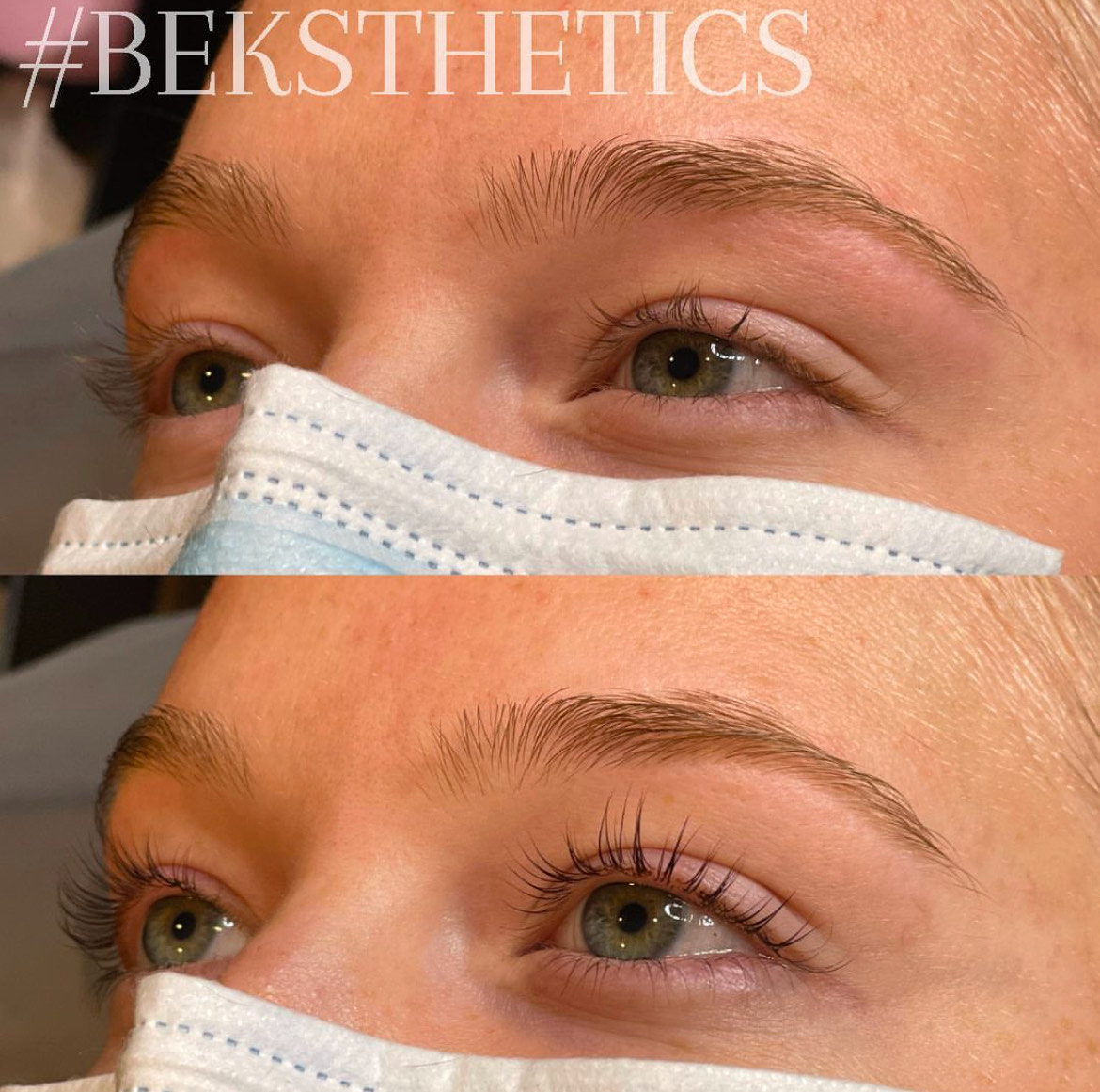 Eyelash Lift