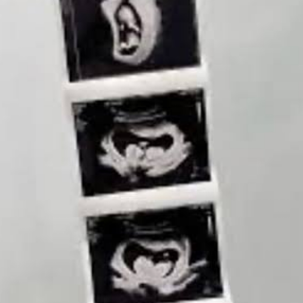 3 Additional 4x6" B&W Prints