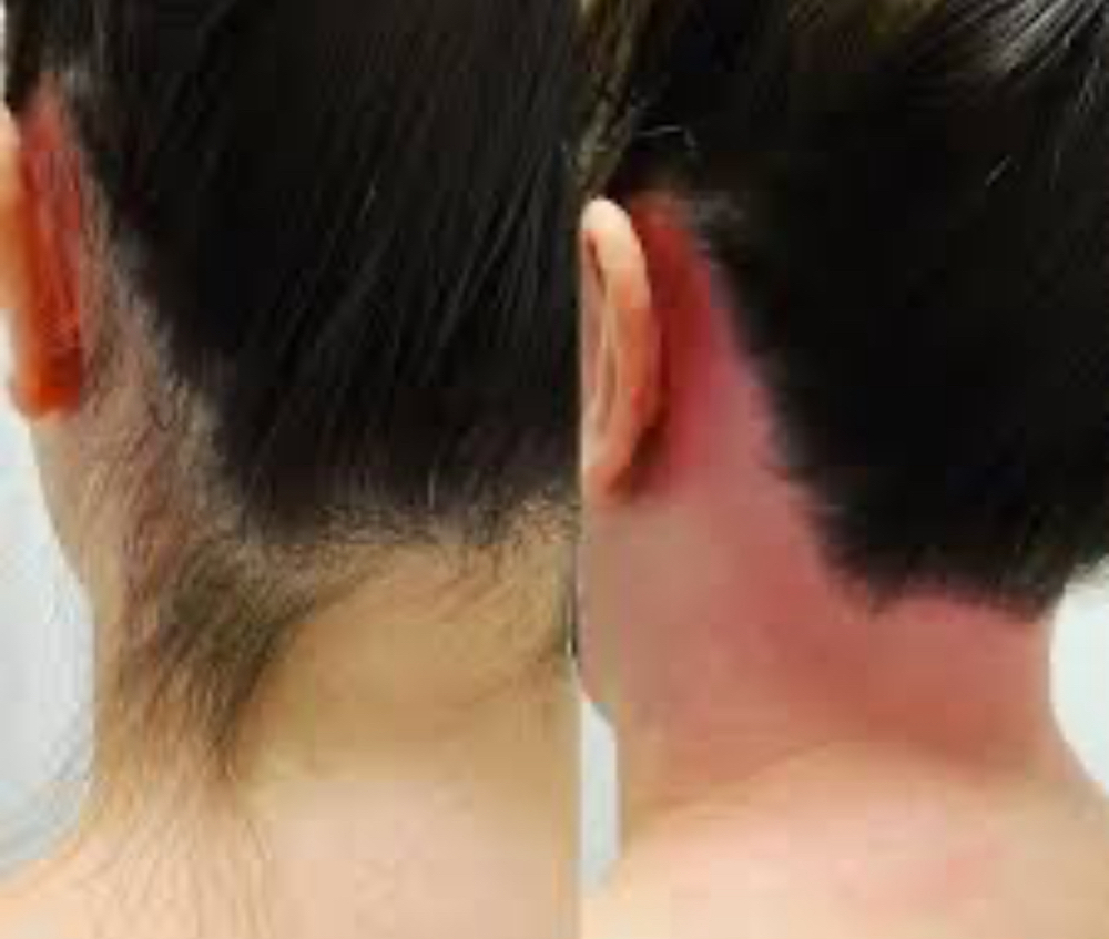 Neck