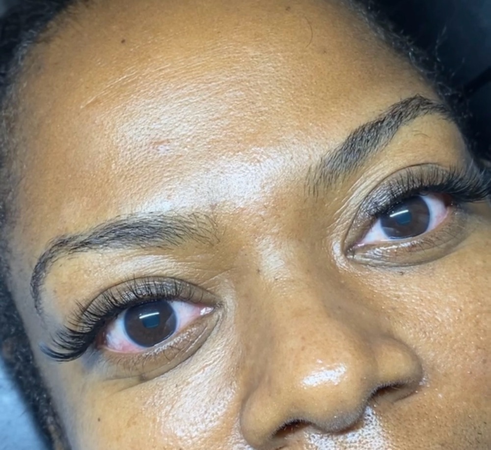 Hybrid Fill ( 3 Weeks) at Inalas_esthetique in Uniondale, NY