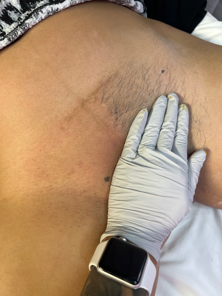Brazilian Sugaring