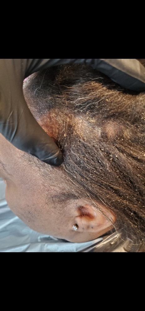 Hair & Scalp Detox