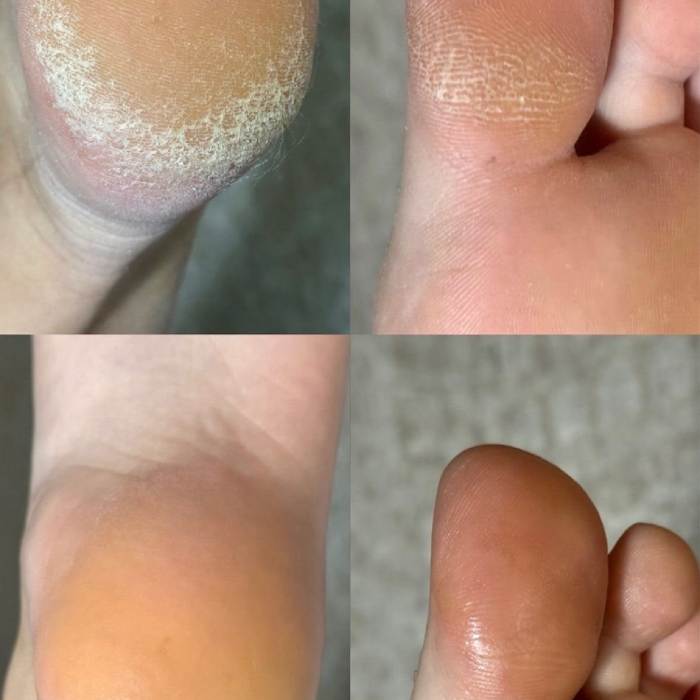 KART Pedicure - First-Time Special at Nail Room in Groveland, FL