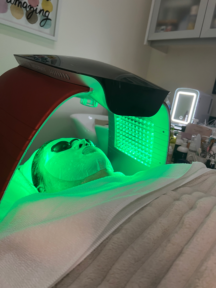 LED Light Therapy Facial